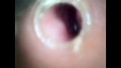 penis camera Thumb