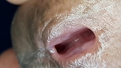 Uretra do penis em close up Thumb