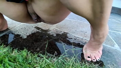 GIRL PEEING ON BEAUTIFUL TOES. I was standing in my own pee while pissing ony own feet Thumb